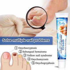 Kem Bôi Nấm Móng Thối Móng SUMIFUN – Chiết Xuất Thiên Nhiên An Toàn, Hỗ Trợ Khắc Phục Móng Yếu, Nấm Móng, Thối Móng