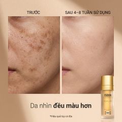 Tinh Chất Mờ Thâm Nám ISDIN Melaclear Advanced 30ml - Làm Sáng, Đều Màu Da, Ngừa Nám, Dưỡng Ẩm Da Mịn Màng