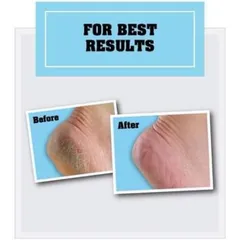 Kem Dưỡng Gót Chân O'Keeffe's Healthy Feet 76g - Dưỡng ẩm, Làm mềm, Chống nứt nẻ, An toàn cho da khô, Hàng Mỹ Date 2027