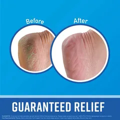 Kem Dưỡng Gót Chân O'Keeffe's Healthy Feet 76g - Dưỡng ẩm, Làm mềm, Chống nứt nẻ, An toàn cho da khô, Hàng Mỹ Date 2027