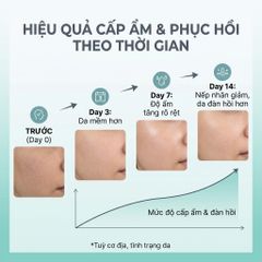 Tinh Chất Cấp Ẩm Phục Hồi Da La Roche-Posay Hyalu B5 Serum 30ml - Giúp Da Căng Mịn & Hỗ Trợ Làm Dịu Da Nhạy Cảm