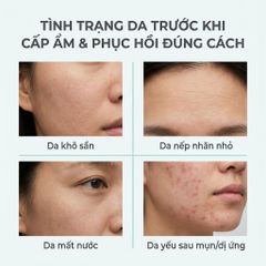 Tinh Chất Cấp Ẩm Phục Hồi Da La Roche-Posay Hyalu B5 Serum 30ml - Giúp Da Căng Mịn & Hỗ Trợ Làm Dịu Da Nhạy Cảm
