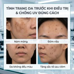 Kem Dưỡng Chống Nám La Roche-Posay Mela B3 40ml - Hỗ Trợ Làm Sáng Da, Mờ Đốm Nâu, Chống Nắng SPF30, Niacinamide, Melasyl