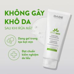 Sữa Rửa Mặt Cho Da Dầu Mụn Stop Akn - Gel Làm Sạch Sâu Ngừa Mụn 100ml, Giúp Da Sáng Khỏe Và Mềm Mại
