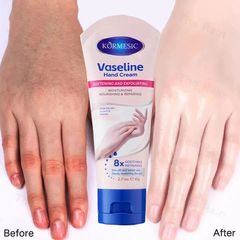 Kem Dưỡng Da Tay Vaseline 60g – Dưỡng Ẩm, Làm Trắng Da, Giúp Da Mịn Màng và Không Nứt Nẻ, Phù Hợp Mọi Loại Da