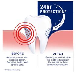 Kem Đánh Răng Sensodyne Extra Whitening 113g không vỏ hộp- Giảm ê buốt, Trắng răng, Hương bạc hà, Nhập khẩu Mỹ