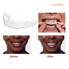 Hàm Răng Giả Silicone Cao Cấp - Nụ Cười Trắng Sáng, Đều Màu Cho Nam Nữ - Giải Pháp Thẩm Mỹ Tiện Lợi