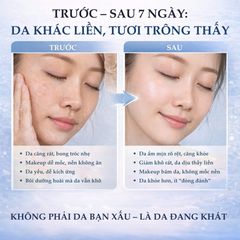 Tinh Chất Cấp Ẩm Phục Hồi Da SVR Ampoule [B3] Hydra 30ml - Vitamin B3 & Hyaluronic Acid Cho Da Khô, Nhạy Cảm, Khỏe Mạnh