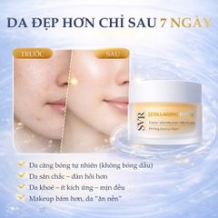 Kem Dưỡng Da SVR Collagen Biotic 50ml - Giúp Da Căng Mịn, Săn Chắc, Cung Cấp Độ Ẩm Tối Đa và Bảo Vệ Da Khỏi Ô Nhiễm