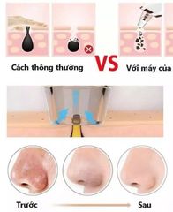 Máy Hút Mụn Đầu Đen Sạc USB - Làm Sạch Da, Loại Bỏ Chất Bẩn, Tăng Độ Đàn Hồi Cho Làn Da, Dễ Dàng Sử Dụng