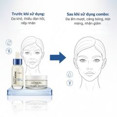 Kem Dưỡng Da L’Oréal Collagen Expert 50ml - Dưỡng Ẩm, Cải Thiện Độ Đàn Hồi và Săn Chắc Da Trưởng Thành