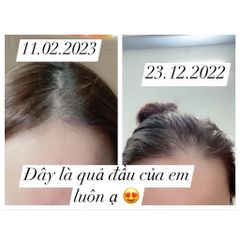 Xịt mọc tóc Minoxidil 5% BAILLEUL - Giảm rụng tóc, kích thích mọc tóc hiệu quả cho nam và nữ - Best Seller Pháp