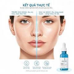 Tinh Chất La Roche-Posay Hyalu B5 50ml - Serum Dưỡng Ẩm, Phục Hồi, Ngừa Lão Hóa, Tái Tạo Da Mặt Rạng Rỡ, Săn Chắc(date 8/27)