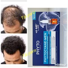 Serum Mọc Tóc Nam Phyto Phytocyane - Ngăn Rụng Tóc, Kích Thích Tăng Mật Độ Tóc, Hộp 12 Ống 7.5ml, Dưỡng Tóc Chắc Khỏe