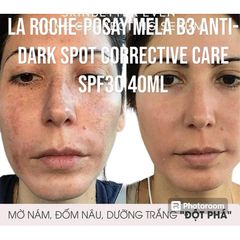Kem Mờ Nám La Roche-Posay Mela B3 SPF30 40ml - Dưỡng Da Sáng, Làm Mờ Đốm Đen và Ngăn Ngừa Tác Hại Tia UV