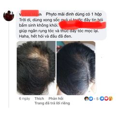 Tinh chất giảm rụng tóc Phyto Phytocyane - Ngăn Rụng Tóc cho Phụ Nữ, Kích Thích Mọc Tóc Mới, Chiết Xuất Tự Nhiên, 12 x 5ml