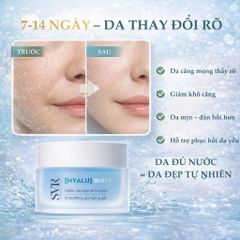 Kem Dưỡng SVR Hyalu Biotic 50ml - Cấp Ẩm, Phục Hồi Da Nhạy Cảm với Hyaluronic Acid & Probiotics - Dược Mỹ Phẩm Pháp