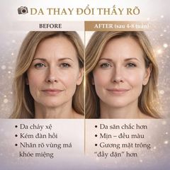 SVR Baume Nuit Densitium – Kem Dưỡng Đêm Phục Hồi & Săn Chắc Da 50ml cho Da Trưởng Thành, Cải Thiện Độ Đàn Hồi