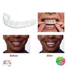 Răng Giả Silicone Trắng Sáng Đẹp - Bộ Bọc Răng Đa Dụng Cho Nụ Cười Xinh Xắn, Phù Hợp Người Lớn