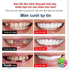 Miếng Dán Hàm Răng Giả Silicone Đa Màu - Sản Phẩm Chăm Sóc Cá Nhân Dễ Vệ Sinh, Sử Dụng Thoải Mái và Tiện Lợi