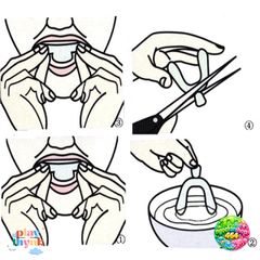 Khay Miệng Silicone Chống Mòn Răng Nghiêng - 2 Miếng Bảo Vệ Răng Khi Ngủ, Chất Liệu EVA, Tiện Lợi Cho Chăm Sóc Răng Miệng