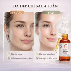 SVR C Ampoule Anti-Ox Serum - Tinh Chất Vitamin C Chống Oxy Hóa & Sáng Da Cho Làn Da Khỏe Mạnh - 30ml