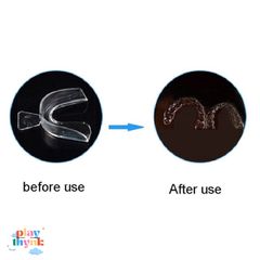 Silicone Bảo Vệ Răng Khi Ngủ - 2 Miếng Đệm Nhẹ Nhàng, Tốt Cho Sức Khỏe Răng Miệng, Giúp Ngủ Ngon Giấc