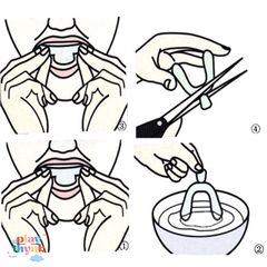 Silicone Bảo Vệ Răng Khi Ngủ - 2 Miếng Đệm Nhẹ Nhàng, Tốt Cho Sức Khỏe Răng Miệng, Giúp Ngủ Ngon Giấc