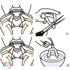 Khay Làm Trắng Răng Silicone Cực Mềm 4 Miếng - Bảo Vệ Răng Khi Ngủ, Phòng Ngừa Mài Răng, Chăm Sóc Răng Miệng Tại Nhà