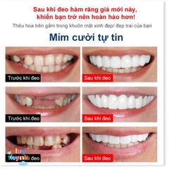 Miếng Dán Hàm Răng Giả Silicone King's Garden - Bộ 2 Cái Dễ Vệ Sinh, Chất Liệu Nhựa PP, Hỗ Trợ Chăm Sóc Cá Nhân