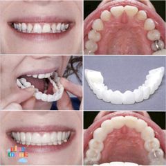 Răng Giả Silicon Tự Nhiên - Set 2 Hàm Răng Giả Mềm Mại, Đeo Thoải Mái, Giải Pháp Thẩm Mỹ Cho Nụ Cười Hoàn Hảo