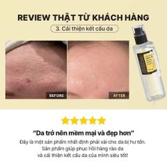 Tinh Chất Dưỡng Ẩm Cosrx Advanced Snail 96 Mucin Power Essence 100ml - Serum Phục Hồi Da, Cấp Nước, Chống Lão Hóa Chính Hãng
