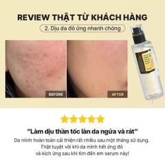 Tinh Chất Dưỡng Ẩm Cosrx Advanced Snail 96 Mucin Power Essence 100ml - Serum Phục Hồi Da, Cấp Nước, Chống Lão Hóa Chính Hãng