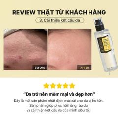 Tinh Chất Dưỡng Ẩm Cosrx Advanced Snail 96 Mucin Power Essence 100ml - Phục Hồi Da, Dưỡng Ẩm Sâu, Chính Hãng Hàn Quốc