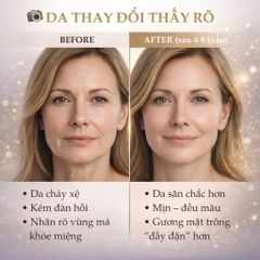 Kem Dưỡng Da Ban Đêm SVR Baume Nuit Densitium 50ml - Phục Hồi & Tái Tạo Da Săn Chắc, Dưỡng Ẩm Cho Da Khô, Thiếu Nước