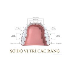 Hộp 2 Mão Răng Thép Răng Sữa 3M ESPE - Bảo Vệ Răng Số 5 Hàm Trên Cho Bé - Chăm Sóc Nha Khoa Trẻ Em Chất Lượng Mỹ