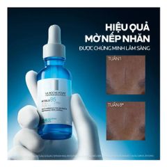 Serum Dưỡng Phục Hồi Da La Roche-Posay Hyalu B5 30ml - Cấp ẩm, Giảm Nếp Nhăn, Tái Tạo Da Mịn Màng Chính Hãng, Dưỡng Da Đặc Biệt cho Tất Cả Loại Da