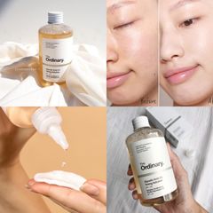 Toner Tẩy Da Chết Hóa Học The Ordinary Glycolic Acid 7% - Giúp Da Mịn Màng Sáng Khỏe, Chống Lão Hóa Chính Hãng
