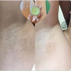 Combo 3 Hộp Kem Cô Bơ Khử Hôi Nách, Giảm Thâm Nách, Chuyên Dụng Cho Phụ Nữ Mang Thai, An Toàn Với Thành Phần Thảo Dược 8gr