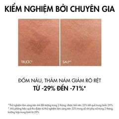 Tinh Chất Ngăn Ngừa Thâm Nám Liftactiv Specialist B3 Serum 30ml Vichy - Dưỡng Da Sáng Mịn, Chống Lão Hóa, Chính Hãng