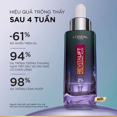 Tinh Chất Dưỡng Da L'Oreal Paris Revitalift 1.5% Hyaluronic Acid Serum 30ml - Chăm Sóc Da Khô, Sáng Mịn, Cấp Ẩm Hiệu Quả