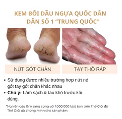 Kem Dưỡng Ẩm Dầu Ngựa 30g - Giảm Nứt Giày Cao Gót & Dưỡng Da Mềm Mại - Sản Phẩm Chăm Sóc Da Chân Chất Lượng Cao