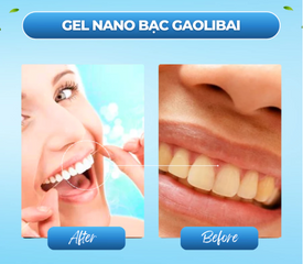 Gel Nano Bạc GAOLIBAI - Kem Đánh Răng Loại Bỏ Mảng Bám & Cao Răng, Trắng Răng, Hơi Thở Thơm Mát, Nhập Khẩu Nhật Bản 120g