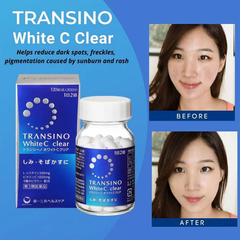 Viên Uống Trắng Da Transino Nhật Bản White C Clear - 120 Viên - Hỗ Trợ Da Sáng Mịn, Cải Thiện Sắc Da Từ Bên Trong
