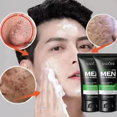 Sữa Rửa Mặt Dành Cho Nam Ngừa Mụn Than Hoạt Tính 100g - Làm Sạch Sâu, Giảm Nhờn, Tươi Mát, Dành Cho Da Đàn Ông