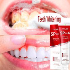 Kem Đánh Răng SP-4 120g - Loại Bỏ Cao Răng, Khử Hôi Miệng, Tẩy Ố Vàng, Làm Trắng Răng Hiệu Quả, Hương Bạc Hà Tươi Mát