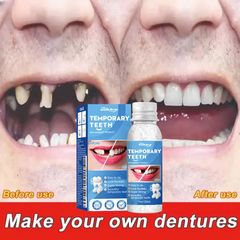 Bộ Dụng Cụ Trám Răng Tức Thời 30ML - Keo Dán Định Hình Răng Giả, Giải Pháp Chăm Sóc Răng Miệng Nhanh Chóng, Tiện Lợi Tại Nhà