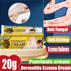Kem Bôi Vảy Nến Giảm Ngứa 20g - Giúp Làm Sạch Gàu, Thoải Mái Da Đầu, Duy Trì Ẩm Mượt Từ South Moon, Chất Lượng Mỹ