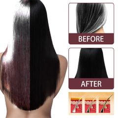 Dầu Gội Xịt Tóc Đen Vĩnh Viễn Hà Thủ Ô - Giải Pháp Chăm Sóc Tóc từ Thảo Mộc, Giúp Mọc Tóc Khỏe Mạnh & Bóng Đẹp tự nhiên