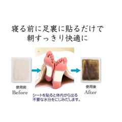 Miếng Dán Thải Độc Chân Kenko Nhật Bản - Hộp 30 Miếng Giúp Thải Độc, Thư Giãn, Cải Thiện Tuần Hoàn Máu